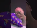 Download Lagu brain aneurism meme exploding but cringy bald guy instead