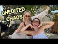 Lunchy Break UNFILTERED with thelilzchannel Botox Confessions Favorites Hotel Fire Update