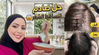 علاج مجرب للصلع وإنبات فراغات الشعر طبيعي وبدون زيوت الحل السحري 💯👆🏻  ونتيجة صدمة جربي بنفسك وحكمي4k