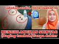 Download Lagu Cara menghilangkan skin tag di Rumah | tips menghilangkan skin tag | kulit tumbuh