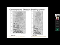 Contemporary Grading and Reporting of Prostate Carcinoma By Dr Lakshmi Priya Kunju