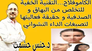 أسرار الكاموفلاج المواد الفعالة طريقةعملها نصائح قبل وبعد الجلسة الإستخدام والموانع هل نتيجتها دائمة دندنها