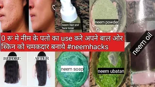 Download नीम के पतो का ऐसा use किसी ने नहीँ बताया होगा//| neem leaf for skin and hair MP3