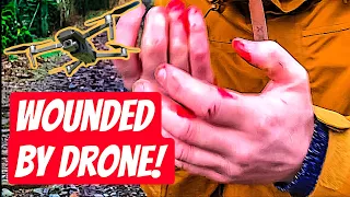 Lake District Drone Crash (Hospitalised)