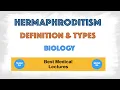 Hermaphroditism Definition Types