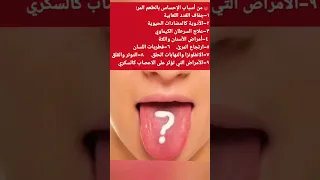 مرارة الفم  اسباب الاحساس بالطعم المر دندنها