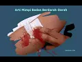 Download Lagu Arti Mimpi Badan Berdarah Darah Yang Sebaiknya Diketahui