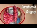 Parathyroid Surgery Traditional Open and Minimally Invasive Approaches