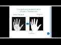 Image Segmentation Image Processing Arabic