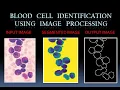 Blood Cell Identification using Image Processing find and count WBC RBC using python Karan Patel