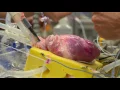 Minnesota lab takes a close-up look at hearts beat by beat LiveBIG 2016-17