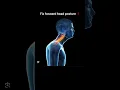Download Lagu How to fix forward head posture (nerd neck)