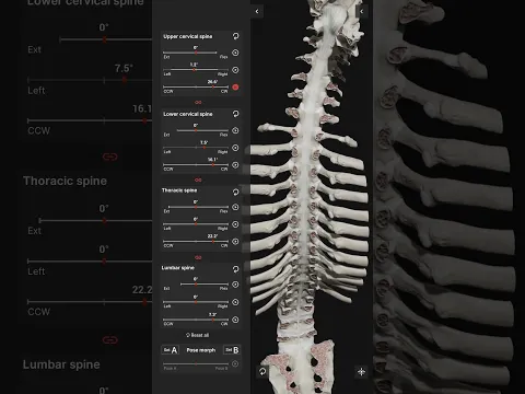 An anterior section of the spinal column during axial rotation #vertebral #intervertebraldiscs
