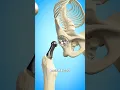 Download Lagu Total Hip Replacement 🤔 (Explained)