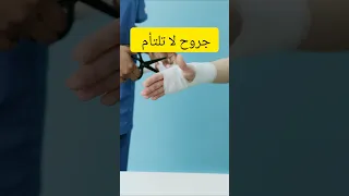 لماذا بعض الجروح لا تلتأم بسهولة   اكسبلور  ترند         دندنها