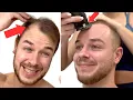 SHAVING My RECEDING HAIRLINE To A Grade 1 BUZZ CUT Transformation