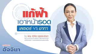 เลเซอร์กับยาทาฝ้า ตัวไหนดีกว่ากัน และมีข้อดีข้อเสียอย่างไรบ้าง