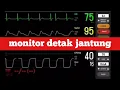 Download Lagu Suara Monitor Detak Jantung di Rumah Sakit