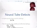 Lecture 6 multifactorial inheritance
