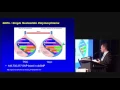 Simon de Denus - What are gene polymorphisms