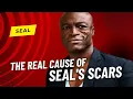 Seal celebrated his 61st birt ay what is the origin of his facial scars