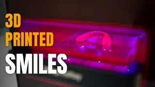 How We 3D Print Your Teeth In-House
