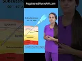Download Lagu Injection Angles (Degrees) Explained: Intramuscular, Subcutaneous, Intradermal, Intravenous #shorts