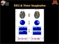 The Brain-computer Interface