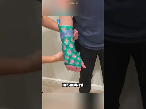Gips Tangan Ini Bisa Mengatasi Rasa Gatal 🩹