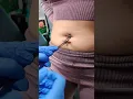 belly piercing by mayur sharma. angel's ink tattoos surat 9925794080 #piercing #youtube  #shorts