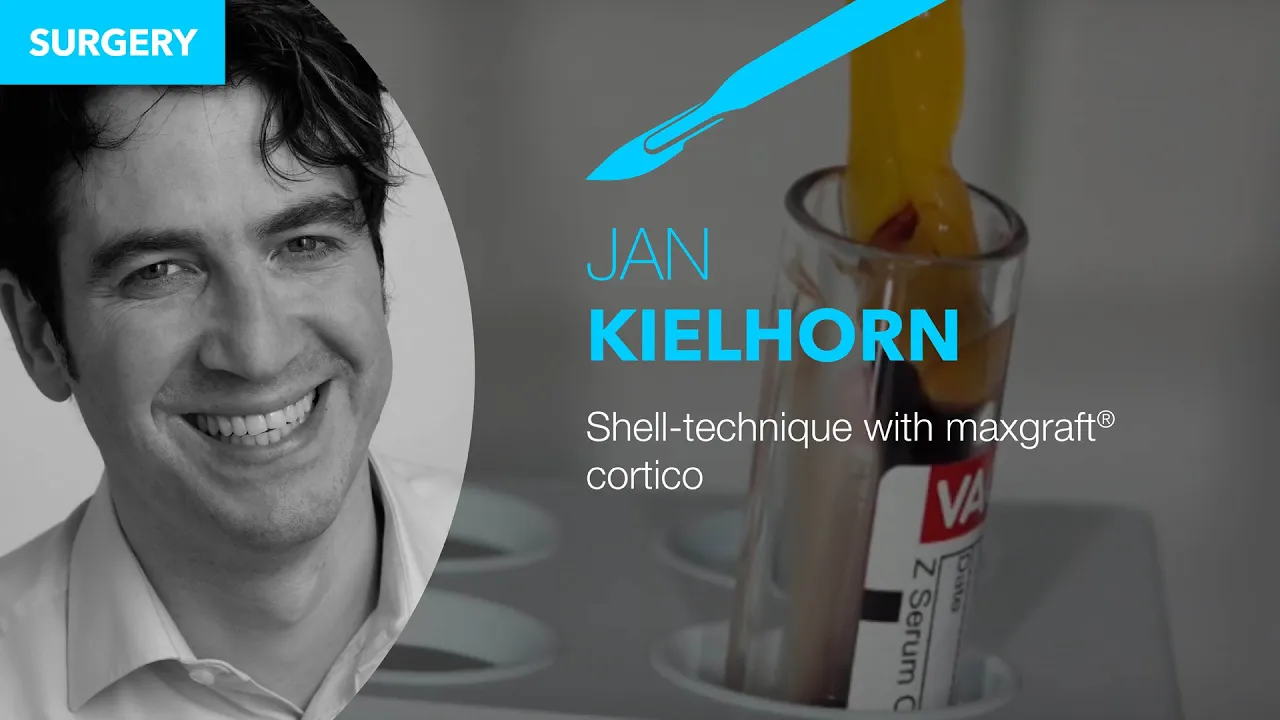 Shell Technique with maxgraft® cortico – Live Surgery