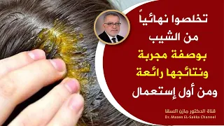 أفضل طرق التخلص من الشيب وازالة الشيب من الشعر نهائيا حتى لوكان الشعر يغزوه الشعر الأبيض نتائج مبهرة دندنها