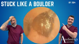 Stuck Like a Boulder – Then a "Forbidden Pringle" – EP1324