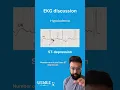 Download Lagu Hypokalemia and EKG Changes: Understanding ST Depression, T Wave Inversion, and Prominent U Waves