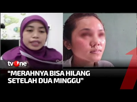 Dampak Buruk Gas Air Mata Bagi Tubuh