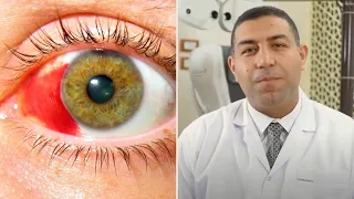 هل وجود بقعة دم في العين  خطير جدا ام لا   دندنها