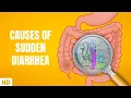 Lagu Causes of Sudden Diarrhea