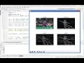 OpenCV Python Tutorial For Beginners 19 - Image Gradients and Edge Detection