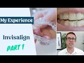 My Invisalign Experience - Things To Know