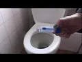 How to collect a poop sample Collecting a stool sample faeces sample collection FIT kit