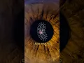 Download Lagu Floaters in your eye #comedy #music #parody of Dancing In The Moonlight by Toploader