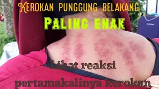  reaksi pertamakali kerokan lihat begini reaksi orang pertamakalinya kerokan 