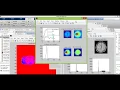 MATLAB code - Brain tumor segmentation using CNN
