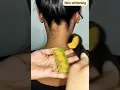 Download Lagu Skin Whitening Tips ll #tanningremove #skincare#hometips #shorts #youtubeshorts