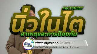 จะป้องกันนิ่วในไตได้อย่างไร