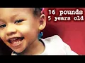 16 Pounds At 5 Years Old The Sickening Case of Cali Anderson
