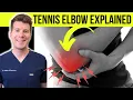Doctor explains TENNIS ELBOW lateral epicondylitis Symptoms causes treatment