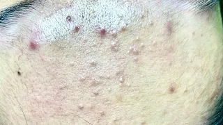 Satisfying video with Chung Vo Spa | 403