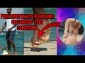 Podiatrist Reacts To Explains Celebrities Foot Conditions