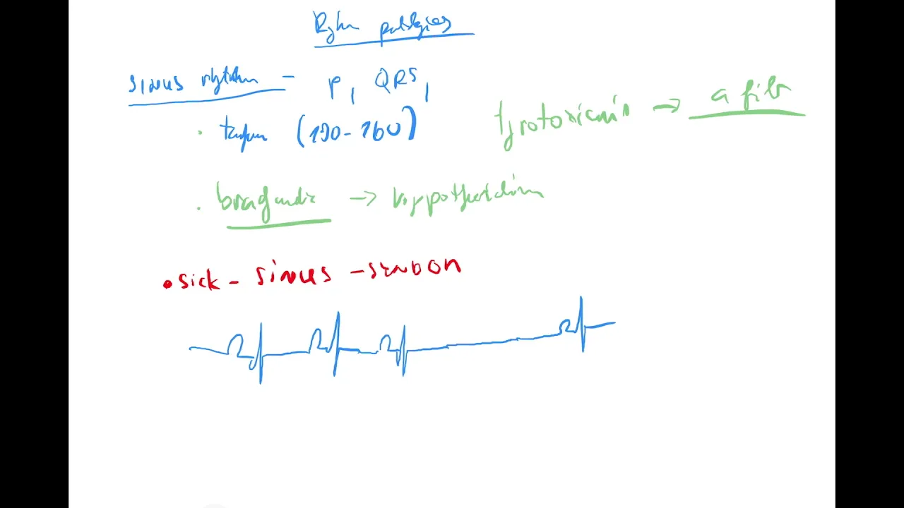 ECG 3 by Coiled ENGLISH (Sinus and atrial rhythms, sick sinus syndrome, SVT, AFIB, atrial flutter)